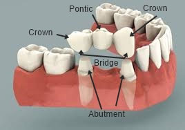 Cosmetic Dentist In Castle Hill: Advantages