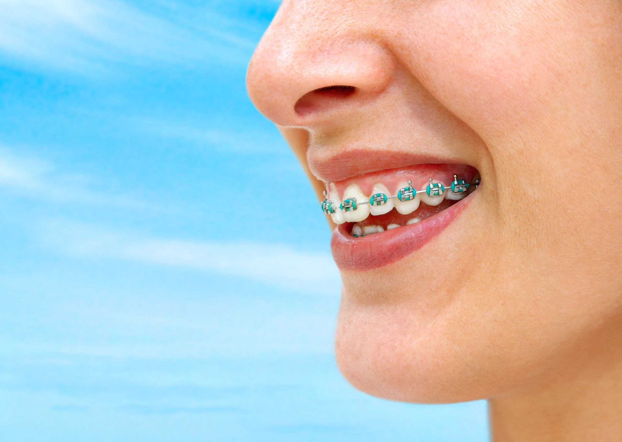 Dental Implants In Castle Hill: Benefits