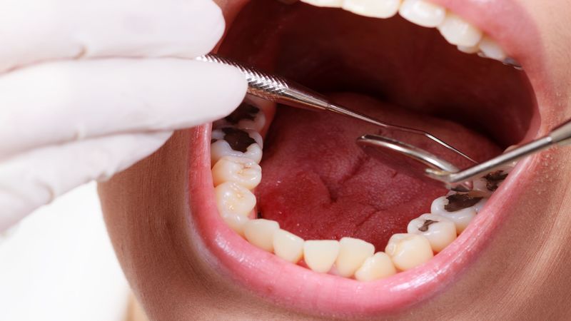 Reasons to Choose a Dental Prosthetist Clinic Southport QLD for Your Dental Care